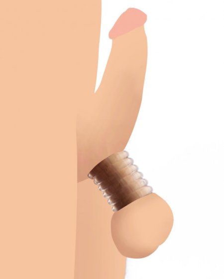 (image for) Ring Master Ball Stretcher Kit - Clear